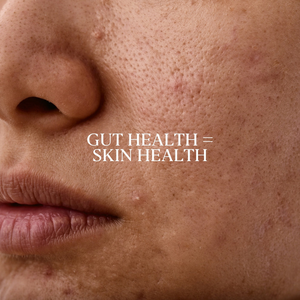 Gut Health = Skin Health