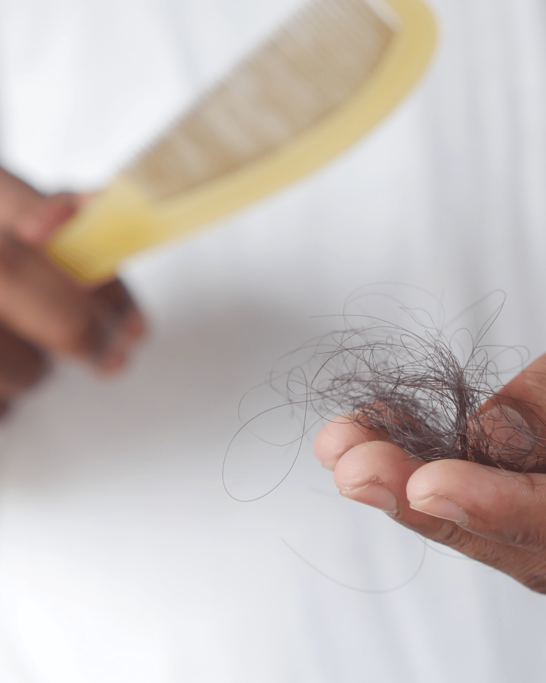 Can Stress Cause Hair Loss? Why Your Hair May Be Thinning and What Your Body Is Telling You
